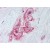 Human Placenta (formalin-fixed, paraffin-embedded) stained with MCAM antibody AP22800PU-N followed by biotinylated goat anti-rabbit IgG secondary antibody, alkaline phosphatase-streptavidin and chromogen.