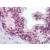 Human Prostate (formalin-fixed, paraffin-embedded) stained with ELF4 antibody AP22807PU-N followed by biotinylated goat anti-rabbit IgG secondary antibody, alkaline phosphatase-streptavidin and chromogen.