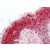 Human Skin (formalin-fixed, paraffin-embedded) stained with SFN antibody AP22876SU-N at 1/250 followed by biotinylated goat anti-rabbit IgG secondary antibody, alkaline phosphatase-streptavidin and chromogen.