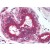 Human Breast (formalin-fixed, paraffin-embedded) stained with YWHAE antibody AP22883SU-N followed by biotinylated goat anti-rabbit IgG secondary antibody, alkaline phosphatase-streptavidin and chromogen.