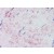 Skeletal muscle. Human: Formalin-Fixed, Paraffin-Embedded (FFPE)