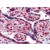 Placenta, Human: Formalin-Fixed, Paraffin-Embedded (FFPE)
