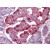 Pancreas, Human: Formalin-Fixed, Paraffin-Embedded (FFPE)