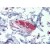 Small intestine, submucosal plexus, Human: Formalin-Fixed, Paraffin-Embedded (FFPE)