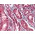 Human Kidney: Formalin-Fixed, Paraffin-Embedded (FFPE)