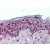 Human Skin: Formalin-Fixed, Paraffin-Embedded (FFPE)