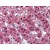 Human Adrenal: Formalin-Fixed, Paraffin-Embedded (FFPE)