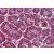 Human Pancreas: Formalin-Fixed, Paraffin-Embedded (FFPE)