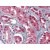 Human Kidney: Formalin-Fixed, Paraffin-Embedded (FFPE)
