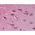 Human Brain, cortex: Formalin-Fixed, Paraffin-Embedded (FFPE)