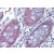 Human Colon: Formalin-Fixed, Paraffin-Embedded (FFPE)
