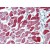 Human Heart: Formalin-Fixed, Paraffin-Embedded (FFPE)
