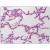 Human Lung: Formalin-Fixed, Paraffin-Embedded (FFPE)