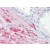 Human Prostate: Formalin-Fixed, Paraffin-Embedded (FFPE)