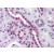 Human Kidney: Formalin-Fixed, Paraffin-Embedded (FFPE)