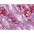 Human Small Intestine: Formalin-Fixed, Paraffin-Embedded (FFPE)