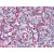Human Spleen: Formalin-Fixed, Paraffin-Embedded (FFPE)
