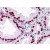 Human Prostate: Formalin-Fixed, Paraffin-Embedded (FFPE)