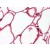 Human Adipocytes: Formalin-Fixed, Paraffin-Embedded (FFPE)