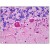 Human Cerebellum: Formalin-Fixed, Paraffin-Embedded (FFPE)