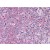 Human Spleen: Formalin-Fixed, Paraffin-Embedded (FFPE)