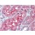 Human Kidney: Formalin-Fixed, Paraffin-Embedded (FFPE)
