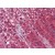 Human Adrenal: Formalin-Fixed, Paraffin-Embedded (FFPE)
