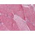 Human Skeletal Muscle: Formalin-Fixed, Paraffin-Embedded (FFPE)