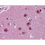Human Brain, Cortex: Formalin-Fixed, Paraffin-Embedded (FFPE)