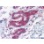 Human Breast: Formalin-Fixed, Paraffin-Embedded (FFPE)