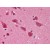 Human Brain, Cortex: Formalin-Fixed, Paraffin-Embedded (FFPE)