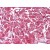 Human Heart: Formalin-Fixed, Paraffin-Embedded (FFPE)