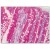 Human Small Intestine: Formalin-Fixed, Paraffin-Embedded.