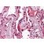 Formalin-Fixed, Paraffin-Embedded Human Lung stained with  CD324 / Cadherin-1 Antibody Cat.-No AM20867PU-N (Clone 3F4) at 3 µg/ml after heat-induced antigen retrieval.