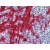 Human Tonsil: Formalin-Fixed, Paraffin-Embedded (FFPE)