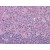 Human Tonsil: Formalin-Fixed, Paraffin-Embedded (FFPE)