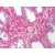 Human Prostate: Formalin-Fixed, Paraffin-Embedded (FFPE)