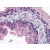 Human Prostate: Formalin-Fixed, Paraffin-Embedded (FFPE)