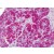 Human Pancreas: Formalin-Fixed, Paraffin-Embedded (FFPE)