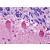 Human Cerebellum: Formalin-Fixed, Paraffin-Embedded (FFPE)