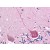 Human Brain, Cerebellum: Formalin-Fixed, Paraffin-Embedded (FFPE)