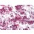 Human Breast: Formalin-Fixed, Paraffin-Embedded (FFPE)