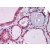 Human Thyroid: Formalin-Fixed, Paraffin-Embedded (FFPE)