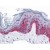 Human Skin: Formalin-Fixed, Paraffin-Embedded (FFPE)