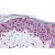 Human Skin: Formalin-Fixed, Paraffin-Embedded (FFPE)