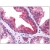 Human Prostate: Formalin-Fixed, Paraffin-Embedded (FFPE)