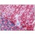 Human Brain, Cerebellum: Formalin-Fixed, Paraffin-Embedded (FFPE)