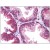 Human Prostate: Formalin-Fixed, Paraffin-Embedded (FFPE)