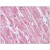 Human Heart: Formalin-Fixed, Paraffin-Embedded (FFPE)