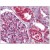 Human Kidney: Formalin-Fixed, Paraffin-Embedded (FFPE)